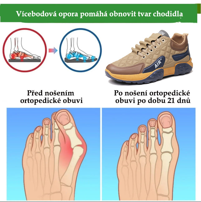 Slancks® | Novinka na trhu – Poloviční cena po omezenou dobu. Ergonomický design, vynikající odpružení a korekce chůze.