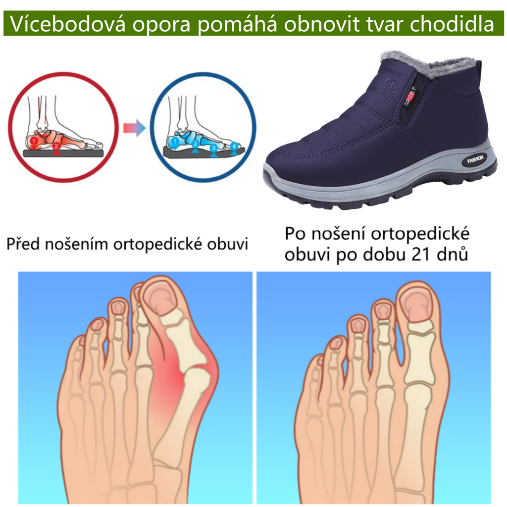 Ergonomická ortopedická obuv Slancks® | Ulevuje od bolesti nohou, zad a kloubů | Unisex