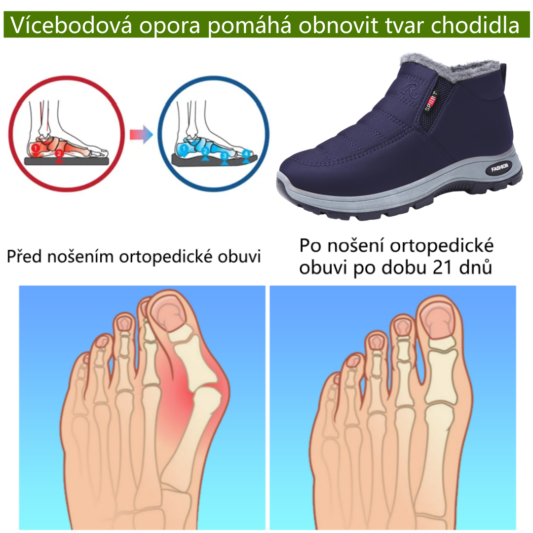Ergonomická ortopedická obuv Slancks® | Ulevuje od bolesti nohou, zad a kloubů | Unisex