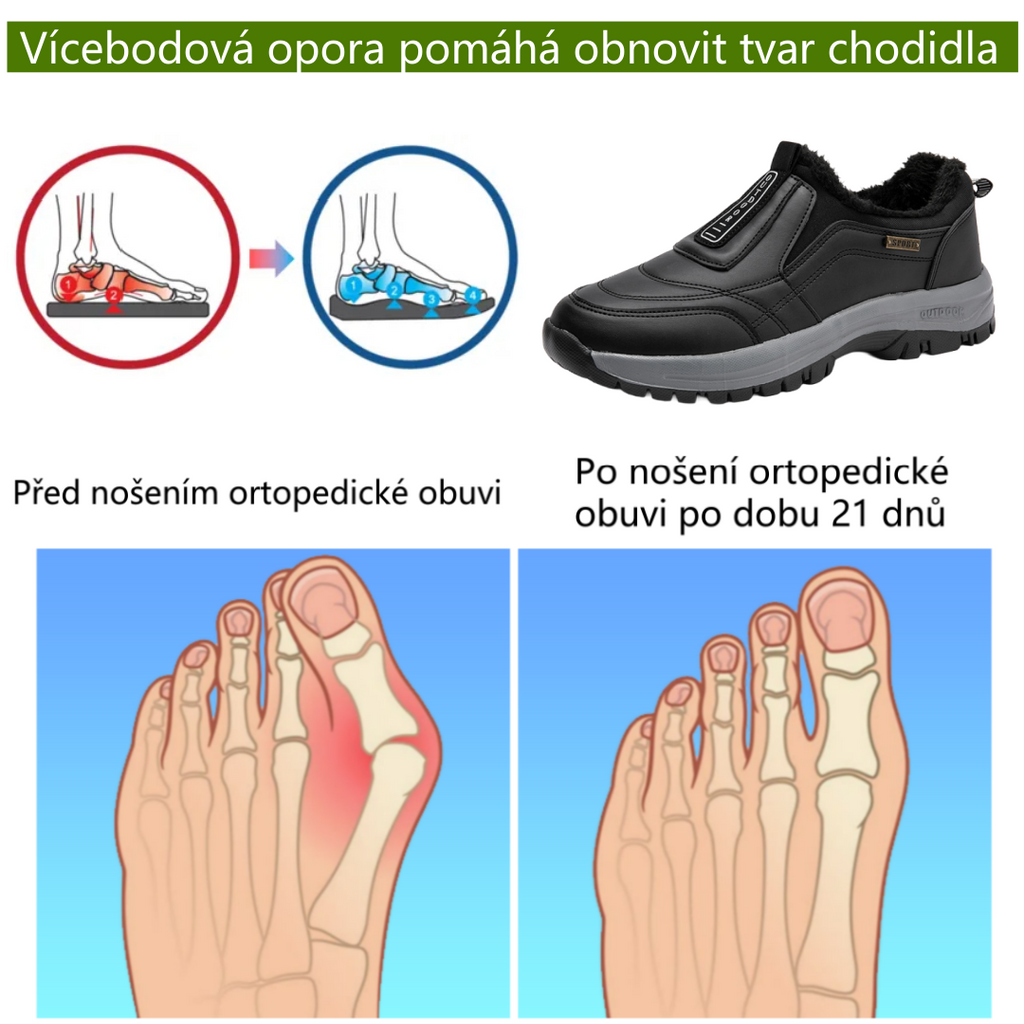 Slancks® | Ergonomicky tvarovaná ortopedická obuv | Plyšová podšívka pro úlevu od bolesti nohou, zad a kloubů | Unisex
