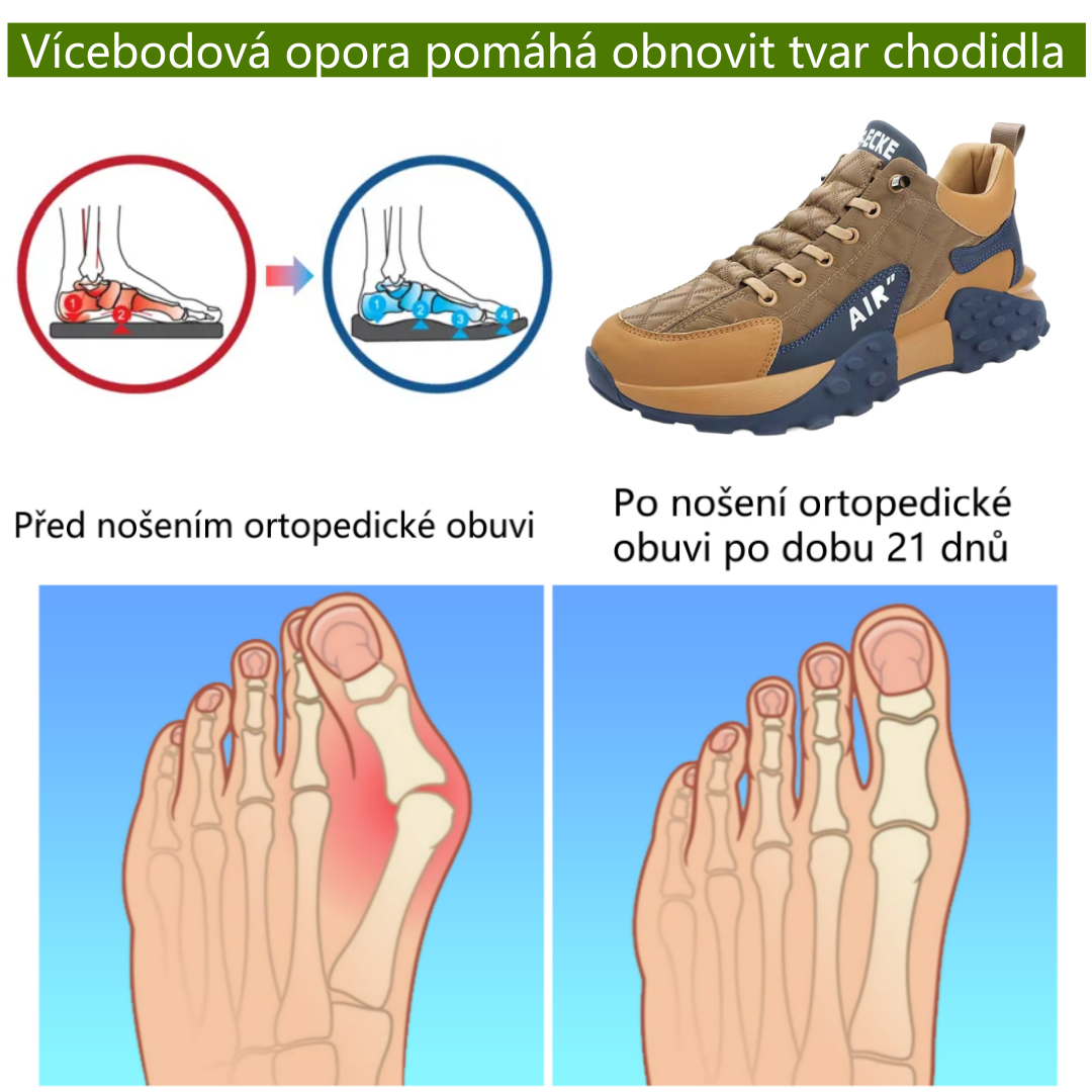 Ortopedická obuv Slancks® | Ergonomicky tvarovaná, měkká a pohodlná, zmírňuje únavu nohou po dlouhém dni.