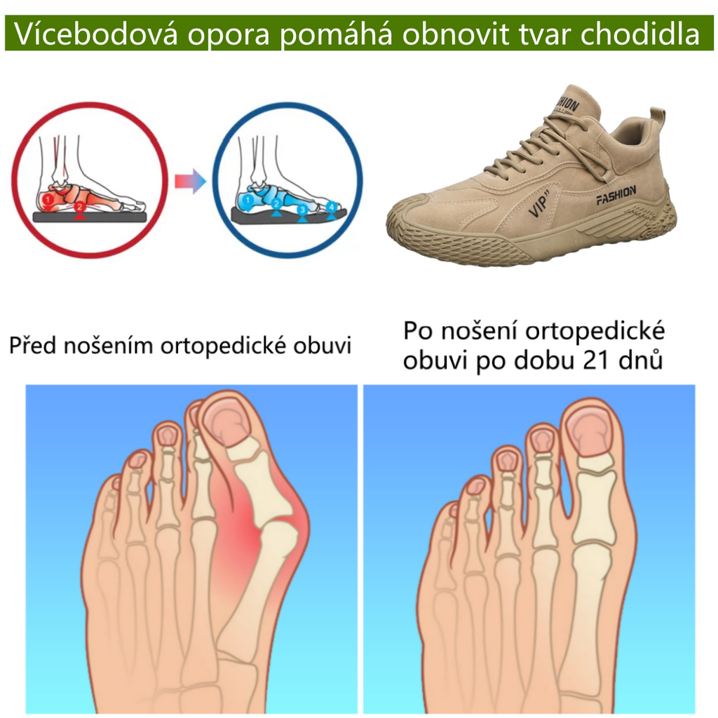⚡Omezený sleva 50 % - Ergonomické ortopedické boty - Pro úlevu od bolesti nohou, zad a kloubů - Ortopedická obuv doporučená ortopedy