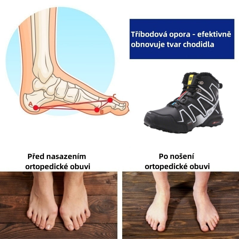 Slancks® | Unisex zimní outdoorová obuv: Ergonomicky navržená pro úlevu od bolesti zad, kloubů a nohou.