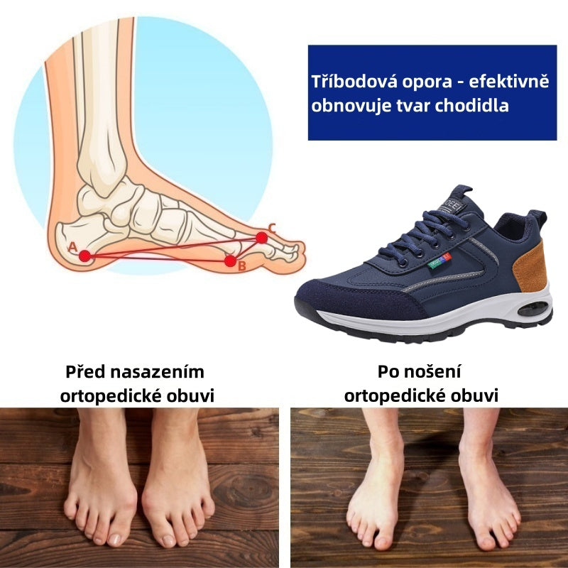 RENMIIX® – Ergonomicky navržená lékařská ortopedická obuv, která ulevuje od bolesti zad, kloubů a nohou.