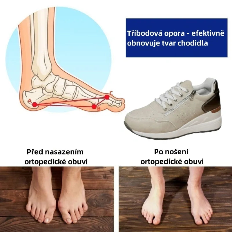 Dámská volnočasová obuv Slancks® | Pohodlné tenisky – Ergonomicky tvarovaná lékařská ortopedická obuv s oporou klenby pro účinnou úlevu od bolesti nohou.