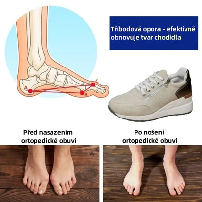 Dámská volnočasová obuv Slancks® | Pohodlné tenisky – Ergonomicky tvarovaná lékařská ortopedická obuv s oporou klenby pro účinnou úlevu od bolesti nohou.