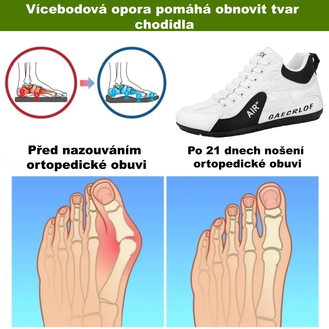 [Dnes sleva 50 % – brzy končí] Ergonomicky tvarovaná ortopedická obuv – prémiová kůže + ručně šitá – nutnost pro muže 👞