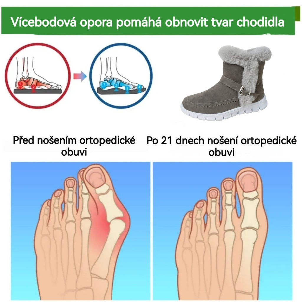 Slancks® | Ergonomická zimní ortopedická obuv pro úlevu od bolesti nohou, kolen a zad.