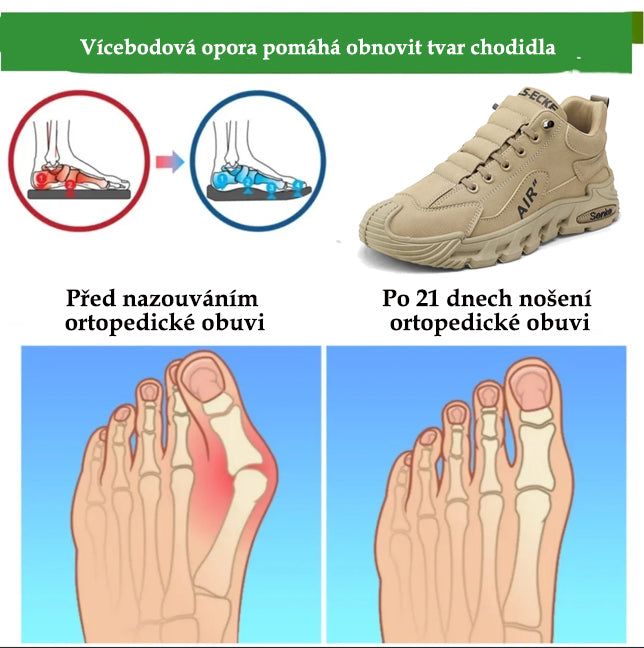 Ortopedická obuv Slancks® | Ergonomická turistická obuv - ✅️Korekce držení těla při chůzi - Voděodolná a protiskluzová 👞Vybraná italská kůže
